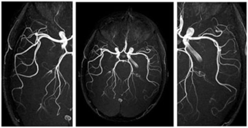 Mr Anjiyo Nasıl Yapılır?